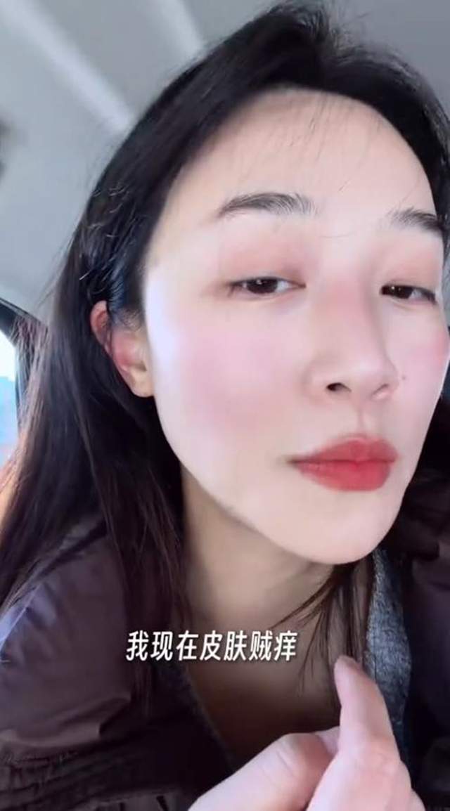 原創(chuàng)藍(lán)盈瑩吉林游玩，零下24度戶外只待半個(gè)小時(shí)就被凍傷，臉又紅又腫