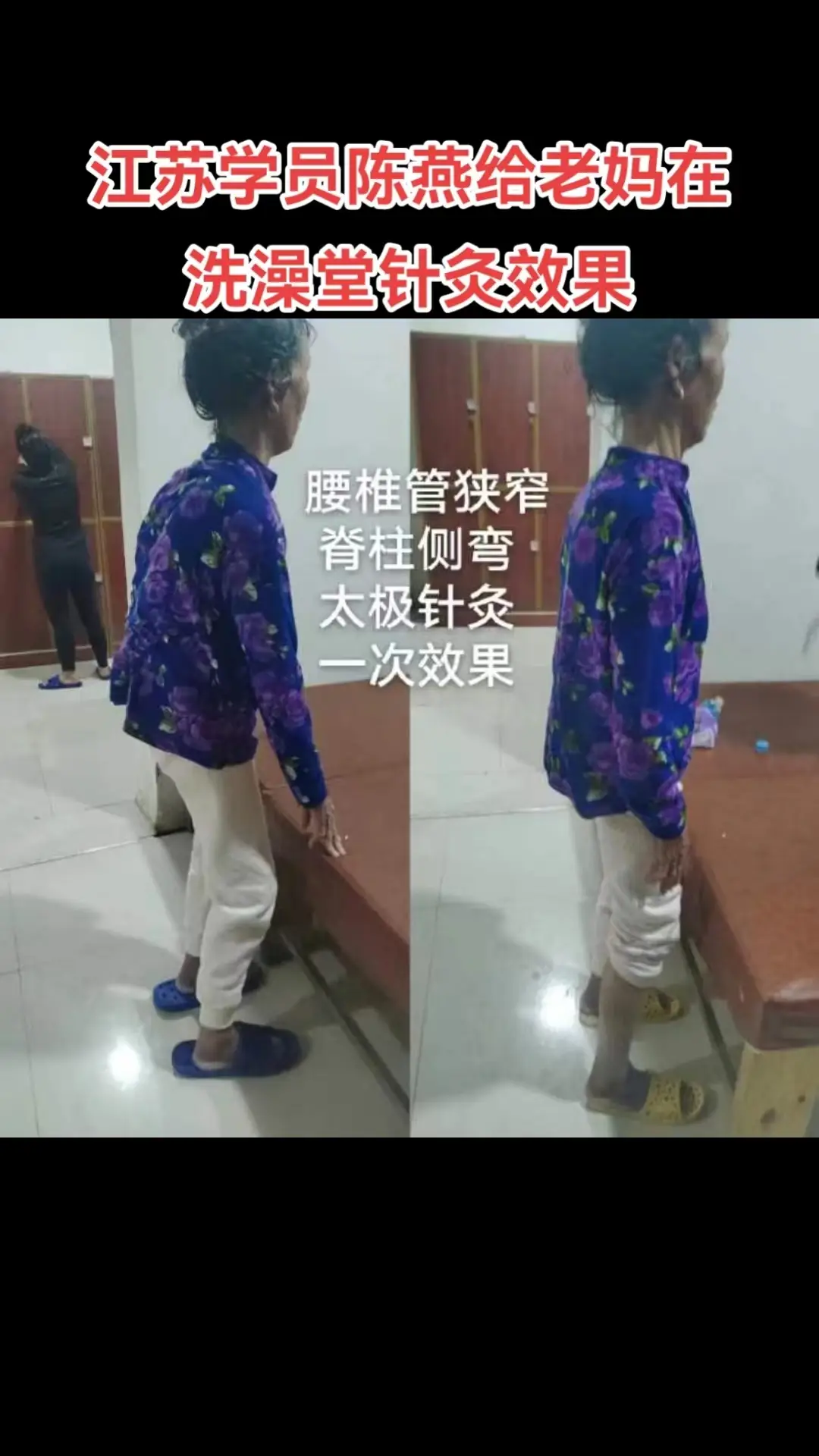 Top巨鹿內(nèi)病外治新療法學(xué)校：中醫(yī)按摩技術(shù)先驅(qū)者，推拿按摩中醫(yī)/足療按摩全流程方案提供者