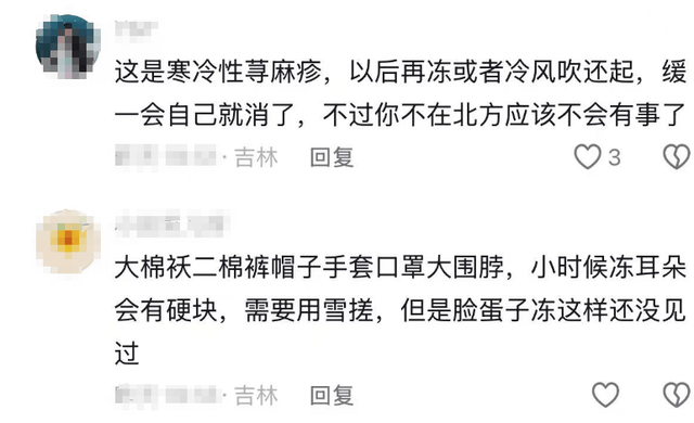 原創(chuàng)藍(lán)盈瑩吉林游玩，零下24度戶外只待半個(gè)小時(shí)就被凍傷，臉又紅又腫