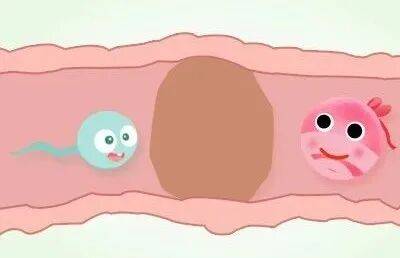 輸卵管這兩個部位容易堵塞，備孕女性要注意