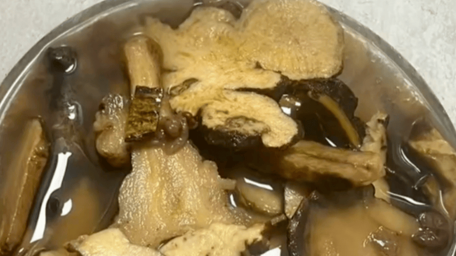 35歲男子不幸喪命！跟風(fēng)“自制熱潮”，警惕良藥變毒藥，美食變“霉”食